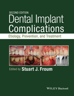 Couverture de l’ouvrage Dental Implant Complications