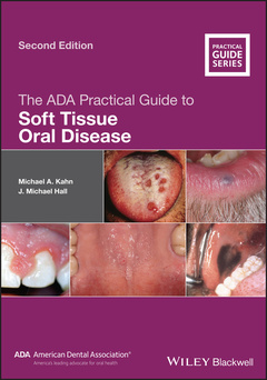 Cover of the book The ADA Practical Guide to Soft Tissue Oral Disease