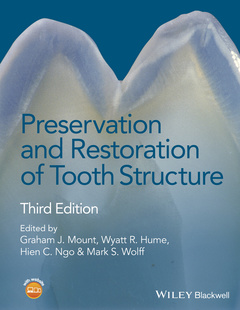 Couverture de l’ouvrage Preservation and Restoration of Tooth Structure