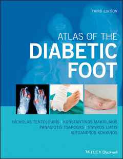 Couverture de l’ouvrage Atlas of the Diabetic Foot