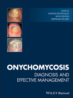 Cover of the book Onychomycosis