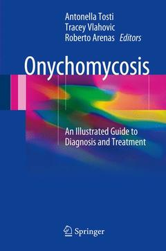 Couverture de l’ouvrage Onychomycosis
