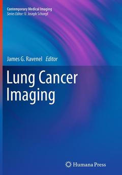 Couverture de l’ouvrage Lung Cancer Imaging