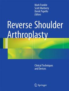 Couverture de l’ouvrage Reverse Shoulder Arthroplasty