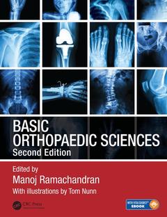 Couverture de l’ouvrage Basic Orthopaedic Sciences