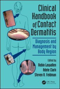 Couverture de l’ouvrage Clinical Handbook of Contact Dermatitis