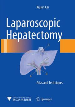 Couverture de l’ouvrage Laparoscopic Hepatectomy