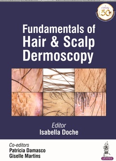 Couverture de l’ouvrage Fundamentals of Hair and Scalp Dermoscopy