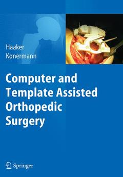Couverture de l’ouvrage Computer and Template Assisted Orthopedic Surgery