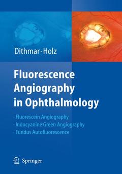 Couverture de l’ouvrage Fluorescence Angiography in Ophthalmology