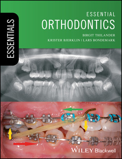Couverture de l’ouvrage Essential Orthodontics