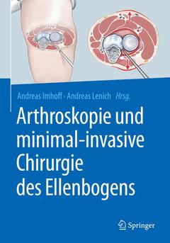 Couverture de l’ouvrage Arthroskopie und minimal-invasive Chirurgie des Ellenbogens