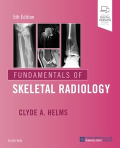 Couverture de l’ouvrage Fundamentals of Skeletal Radiology
