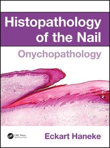 Couverture de l’ouvrage Histopathology of the Nail