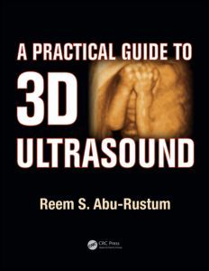 Couverture de l’ouvrage A Practical Guide to 3D Ultrasound