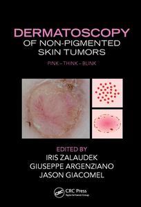 Couverture de l’ouvrage Dermatoscopy of Non-Pigmented Skin Tumors