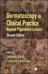 Couverture de l’ouvrage Dermatoscopy in Clinical Practice