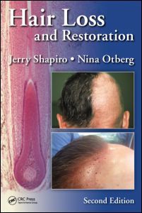 Couverture de l’ouvrage Hair Loss and Restoration