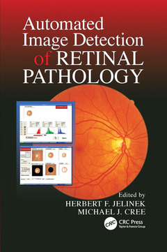 Couverture de l’ouvrage Automated Image Detection of Retinal Pathology