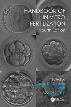 Cover of the book Handbook of In Vitro Fertilization