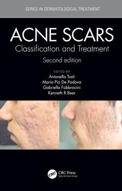 Couverture de l’ouvrage Acne Scars
