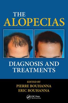 Couverture de l’ouvrage The Alopecias