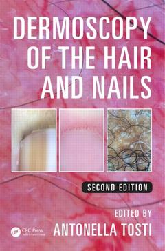 Couverture de l’ouvrage Dermoscopy of the Hair and Nails
