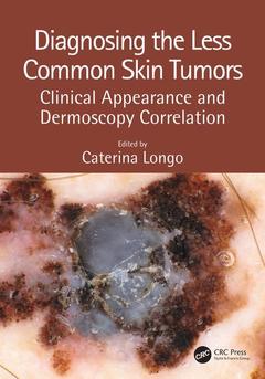 Couverture de l’ouvrage Diagnosing the Less Common Skin Tumors