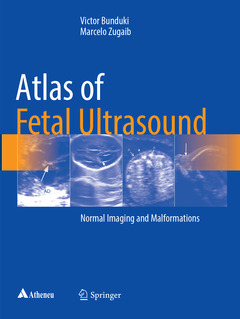 Couverture de l’ouvrage Atlas of Fetal Ultrasound