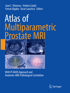 Couverture de l’ouvrage Atlas of Multiparametric Prostate MRI