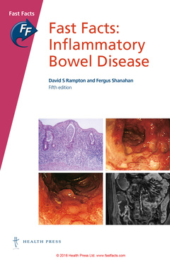 Couverture de l’ouvrage Fast Facts: Inflammatory Bowel Disease