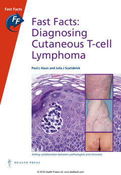 Cover of the book Fast Facts: Diagnosing Cutaneous T-Cell Lymphoma