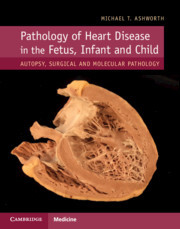 Couverture de l’ouvrage Pathology of Heart Disease in the Fetus, Infant and Child