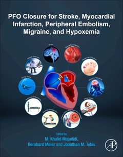 Cover of the book Patent Foramen Ovale Closure for Stroke, Myocardial Infarction, Peripheral Embolism, Migraine, and Hypoxemia