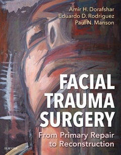 Couverture de l’ouvrage Facial Trauma Surgery