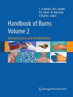 Couverture de l’ouvrage Handbook of Burns Volume 2
