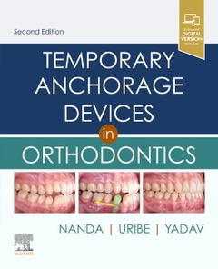 Cover of the book Temporary Anchorage Devices in Orthodontics