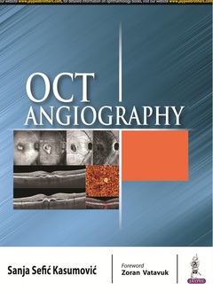 Couverture de l’ouvrage OCT Angiography