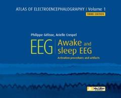 Cover of the book Atlas of electroencephalography - Volume 1
