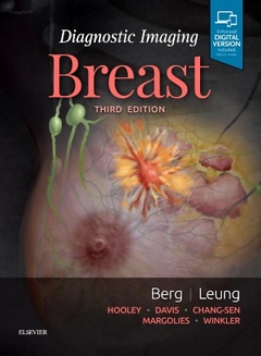Couverture de l’ouvrage Diagnostic Imaging: Breast