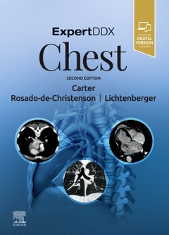 Cover of the book ExpertDDx: Chest