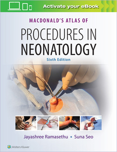 Couverture de l’ouvrage MacDonald's Atlas of Procedures in Neonatology