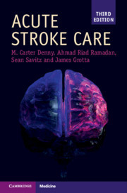Couverture de l’ouvrage Acute Stroke Care