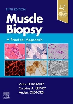 Couverture de l’ouvrage Muscle Biopsy