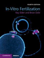 Cover of the book In-Vitro Fertilization