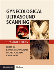 Couverture de l’ouvrage Gynaecological Ultrasound Scanning