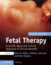 Couverture de l’ouvrage Fetal Therapy