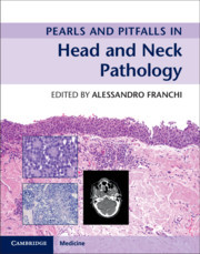 Couverture de l’ouvrage Pearls and Pitfalls in Head and Neck Pathology