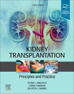 Cover of the book Kidney Transplantation - Principles and Practice