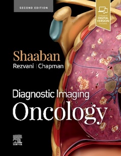 Couverture de l’ouvrage Diagnostic Imaging: Oncology